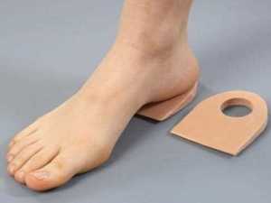 Topuk dikenine ameliyatsız tedavi