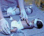 Dört bebekten biri enfeksiyondan ölmüş