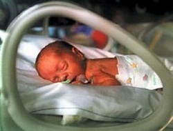 Her 10 bebekten 1'i prematüre doğuyor