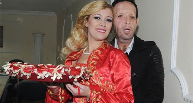 Yüz nakli yapılan Sert, baba olacak