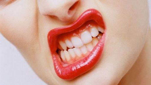 Diş gıcırdatmanın tedavisi var mı?