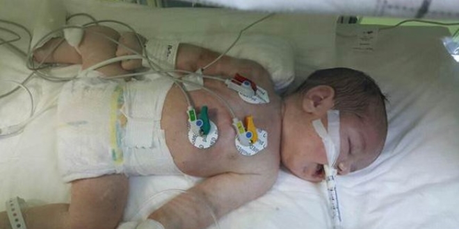 İzmir'de ebe dehşeti, bebek 2.5 aydır yaşam savaşı veriyor