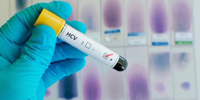 FDA, Hepatit C için ilk ilaç kombinasyonunu onayladı