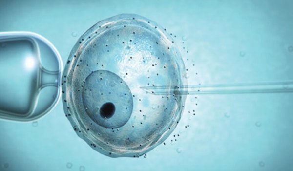 Tüp bebek merkezi doktoru kendi spermini kullanmış!