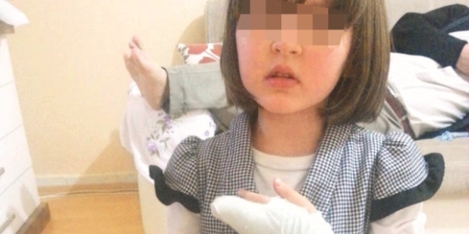Okulda kız öğrencinin parmağı koptu