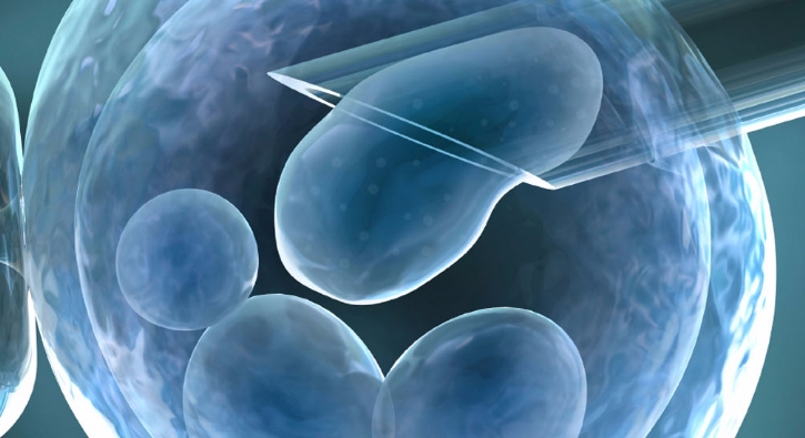 Bebeği olmayan çiftlere yeni umut