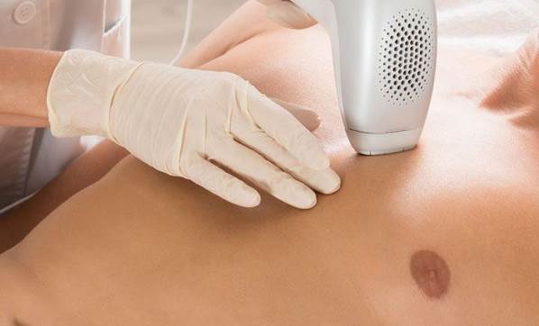 İzmir'de benzeri görülmemiş 'penisimi yaktın' davası