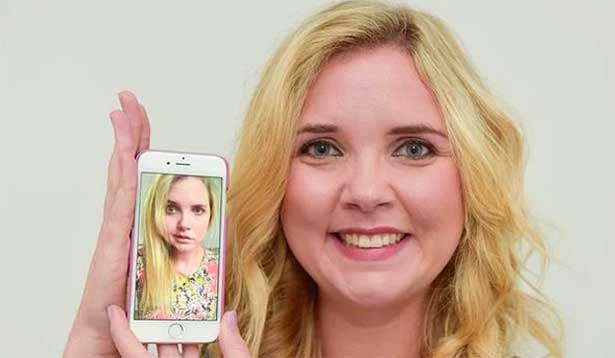 Selfie yüz felci tedavisinde yardımcı olabilir