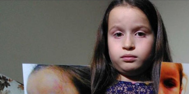 Bursa'da küçük kızın doktor tarafından dövüldüğü iddiası