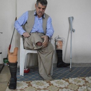 45 yıllık sigara tiryakisinin ibretlik hikayesi