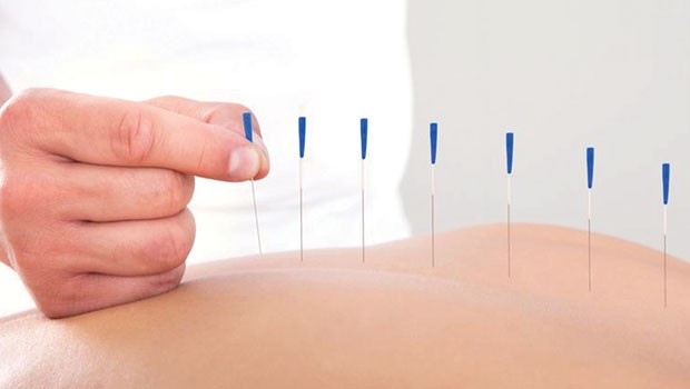 Devlet hastanesinde hacamat ve akupunktur polikliniği açıldı!