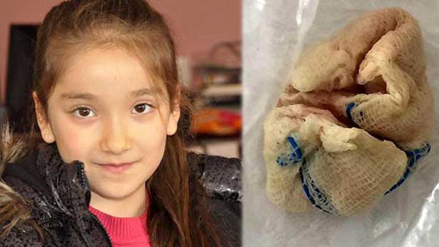 Bademcik ameliyatı olan kızın boğazında gazlı bez unutuldu