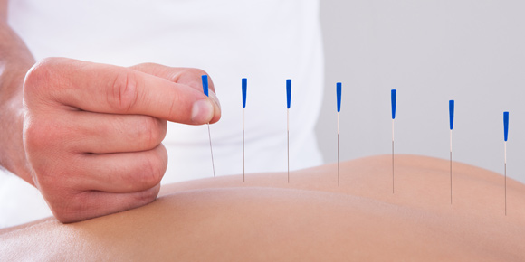 Devlet hastanesinde Akupunktur tedavisi başladı