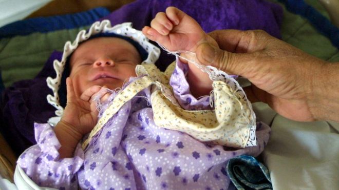 50 yıldır kullanılan bu ilaç 4 bin 100 kusurlu doğuma yol açmış olabilir!