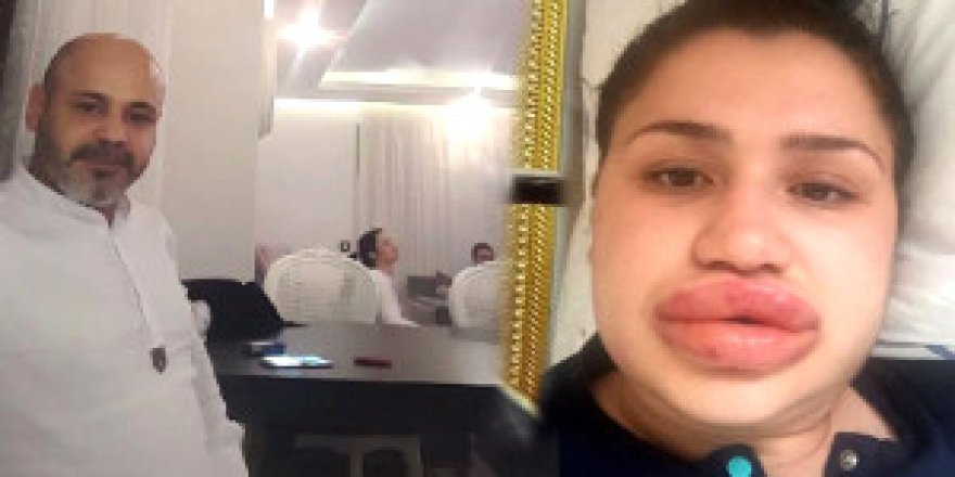 Silikon mağduru merve hemşireye mahkemede şok suçlama