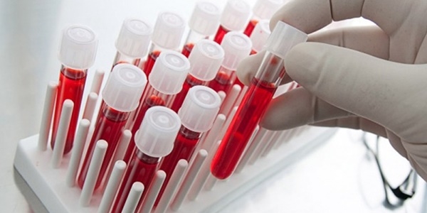 Kansızlık dünya nüfusunun yüzde 30'unu etkiliyor