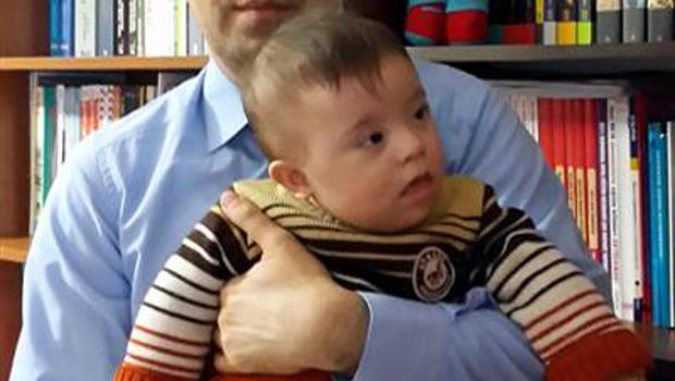 Çocukları down sendromlu doğan anne-baba'dan tazminat davası