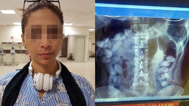 İç organlarında 78 adet kokain kapsülüyle yakalandı