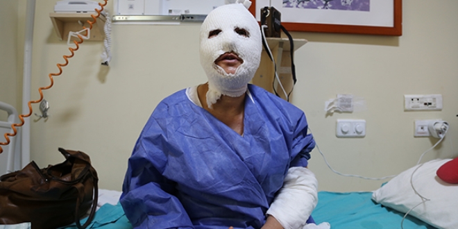 Sabırsızlığı yüzünden patlayan düdüklü hastanelik etti