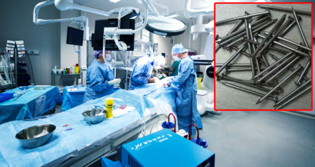 Mide ağrısıyla doktora başvuran hastanın bağırsağından 639 adet çivi çıktı