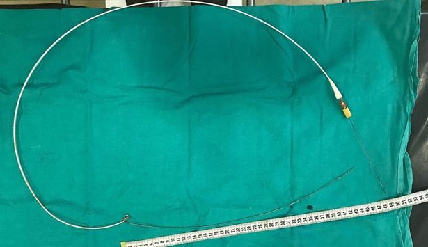 Kalp-damar cerrahının hatasını 6 yıl sonra ürolog fark etti!