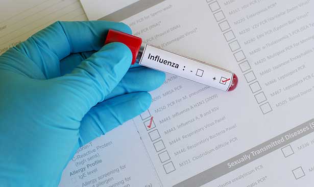 Grip virüsü tıp dünyasını zorluyor!