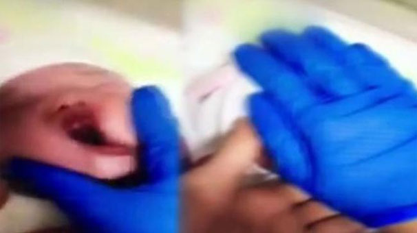 Samsun'da özel hastanede skandal görüntüler!