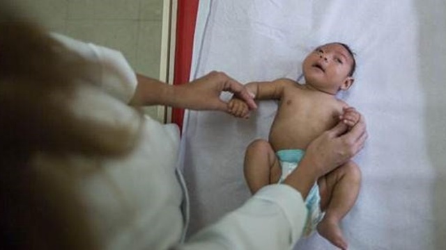 Zika virüsü Türkiye'de! Sağlık Bakanlığı'ndan flaş açıklama