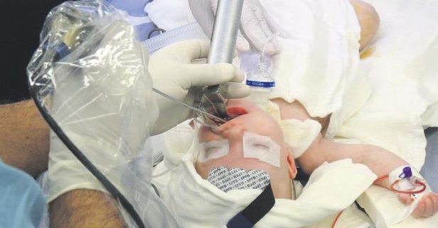 Hüseyin bebeğe ithal doktor!