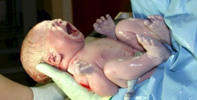 Sezaryen doğumlar dünya genelinde iki kat arttı
