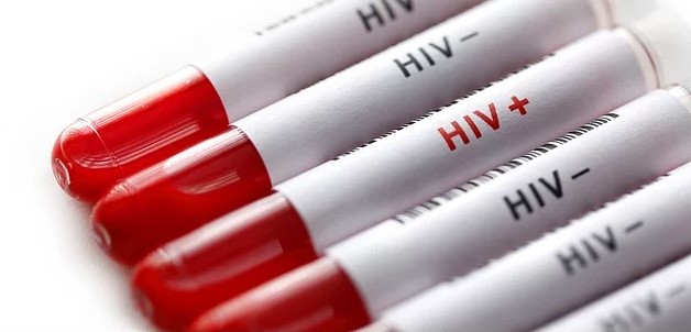 Geçen yıl dünyada 36 milyon kişi HIV virüsüne yakalandı
