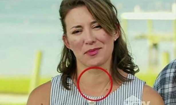 Canlı yayını izleyen doktor teşhis etti... Genç kadın tedaviye alındı