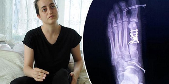 Yanlış parmağı ameliyat eden doktor açığa alındı