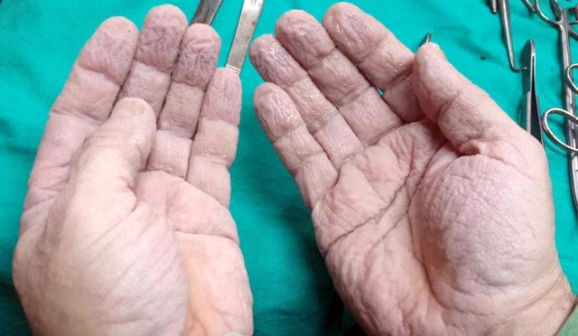 Ameliyat sonrası ellerini paylaşan cerrah sosyal medyayı salladı