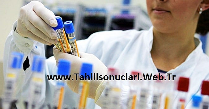 Tahlil Sonuçlarınızı Online  Öğrenmek İçin Hizmet Veren Web Sitesi Yayında