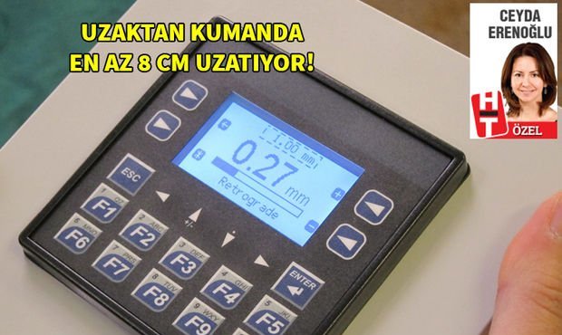 Uzaktan kumanda edilebilir çiviler ile kemik boyu uzatma