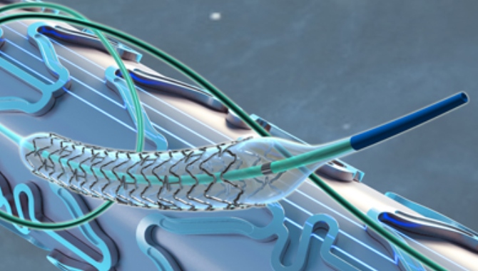 Koroner kalp hastalığına mikro stent