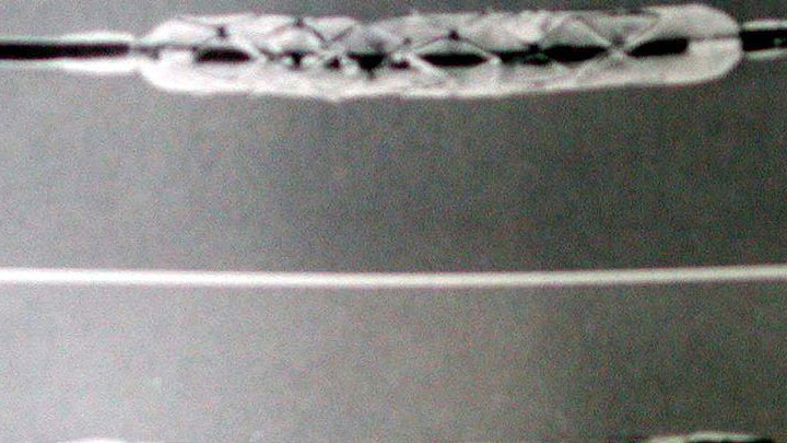 Koroner kalp hastalığı için mikro stent geliştirildi