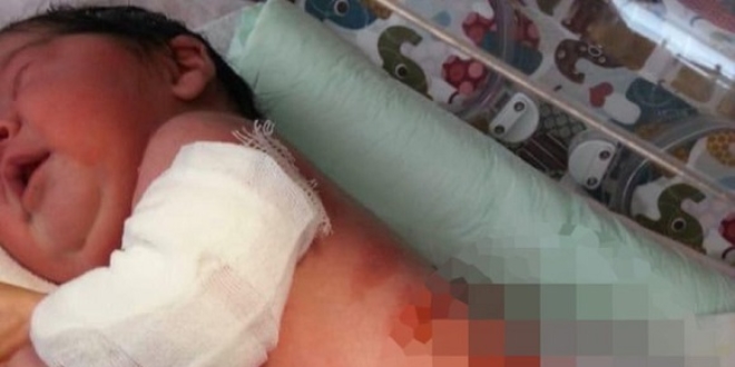 Konya'da doğumhanede dehşet! Bebeğin vücudunda 2. derecede yanıklar oluştu