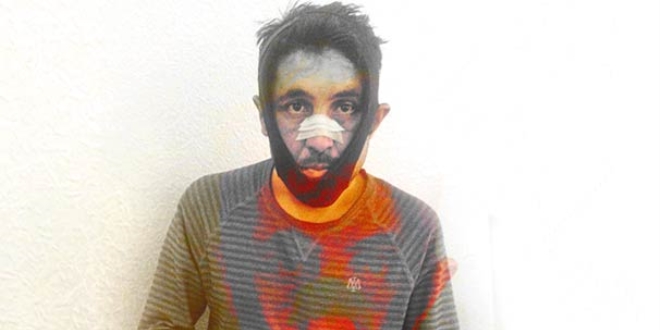 Dayanamayıp şikayet etti! Ölümüne dayak yedi