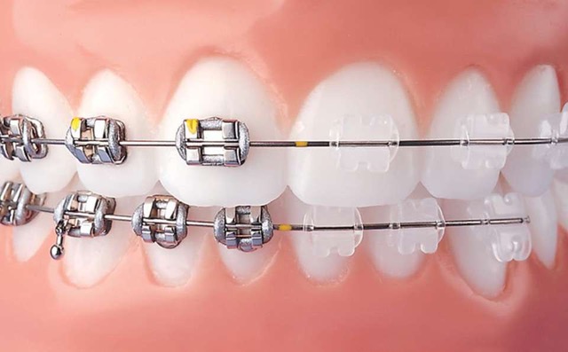 Manisa Ortodonti, İmplant ve Diş Estetiği Kliniği