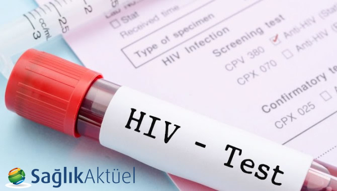 Türkiye'de HIV pozitif sayısı 6 yılda 4 kattan fazla arttı