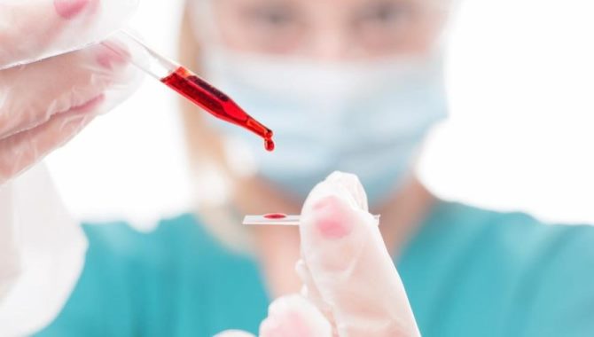 Tüberküloz yatkınlığına neden olan "gen" keşfedildi