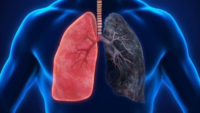 Akciğer kanserine 'nefes yoluyla' teşhis