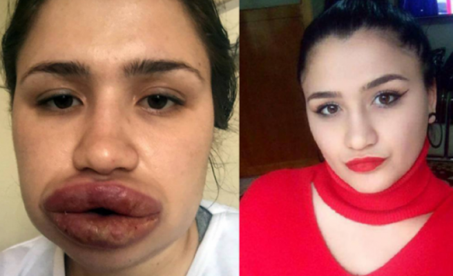 Sahte estetikçi cezaevinden firar etti