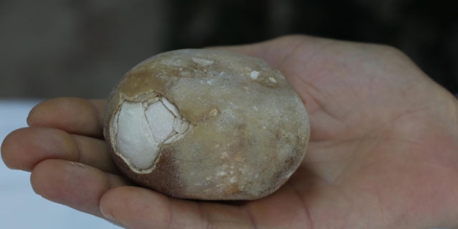 Mesanesinden 522 gramlık tek parça taş çıktı