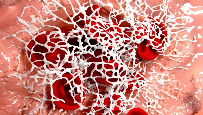 Hemofili hastalığının anne karnında teşhisi mümkün