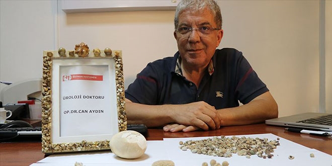 Hastaların kurtulduğu 'taşlar' doktorun koleksiyon oldu