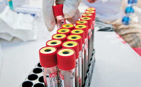 Almanya'da günde 200 bin koronavirüs testi yapılması amaçlanıyor