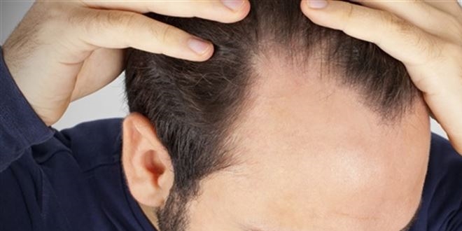 Yanlış beslenme saçları döküyor